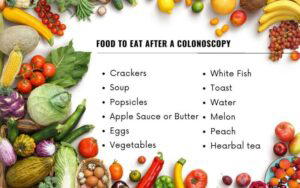 What To Eat After Colonoscopy: Guide To Managing Your Colonoscopy With Ease • BoatBasinCafe